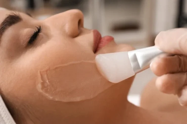 Chemical Peeling----0