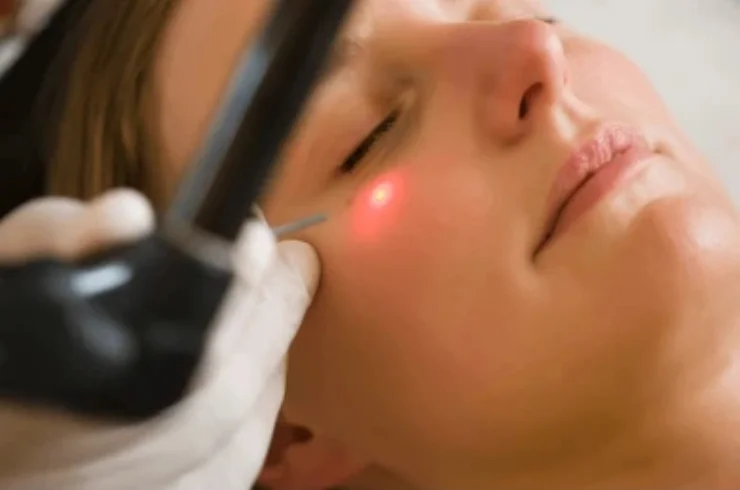 Laser Treatments-----0