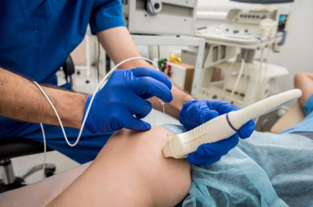Radiofrequency_ Electro Cautery-----11