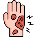 infection