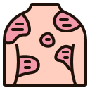 psoriasis (2)