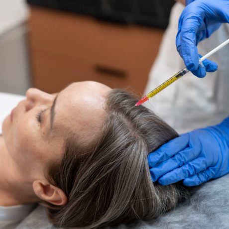 PRP, Aira Skin Clinic, Dr. Bhavana Dhana Laxmi