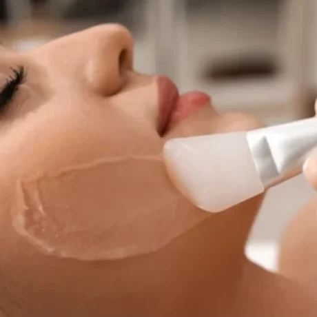 Chemical Peeling----0