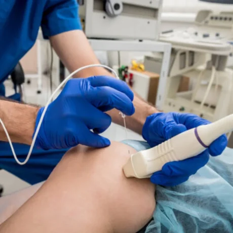 Radiofrequency_ Electro Cautery-----11